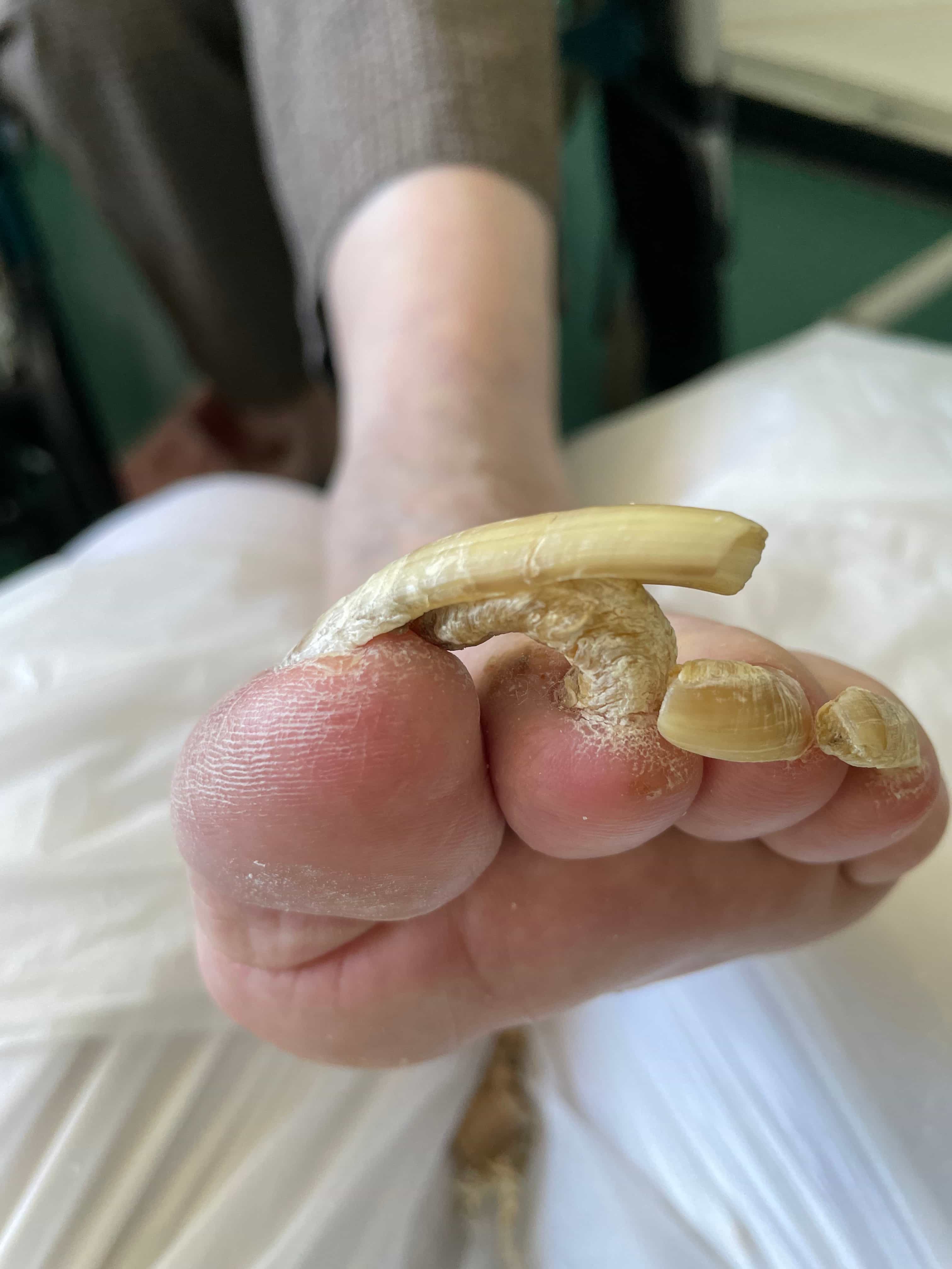 soin pedicure avant