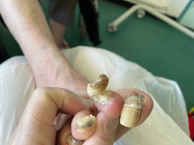 soin pedicure avant