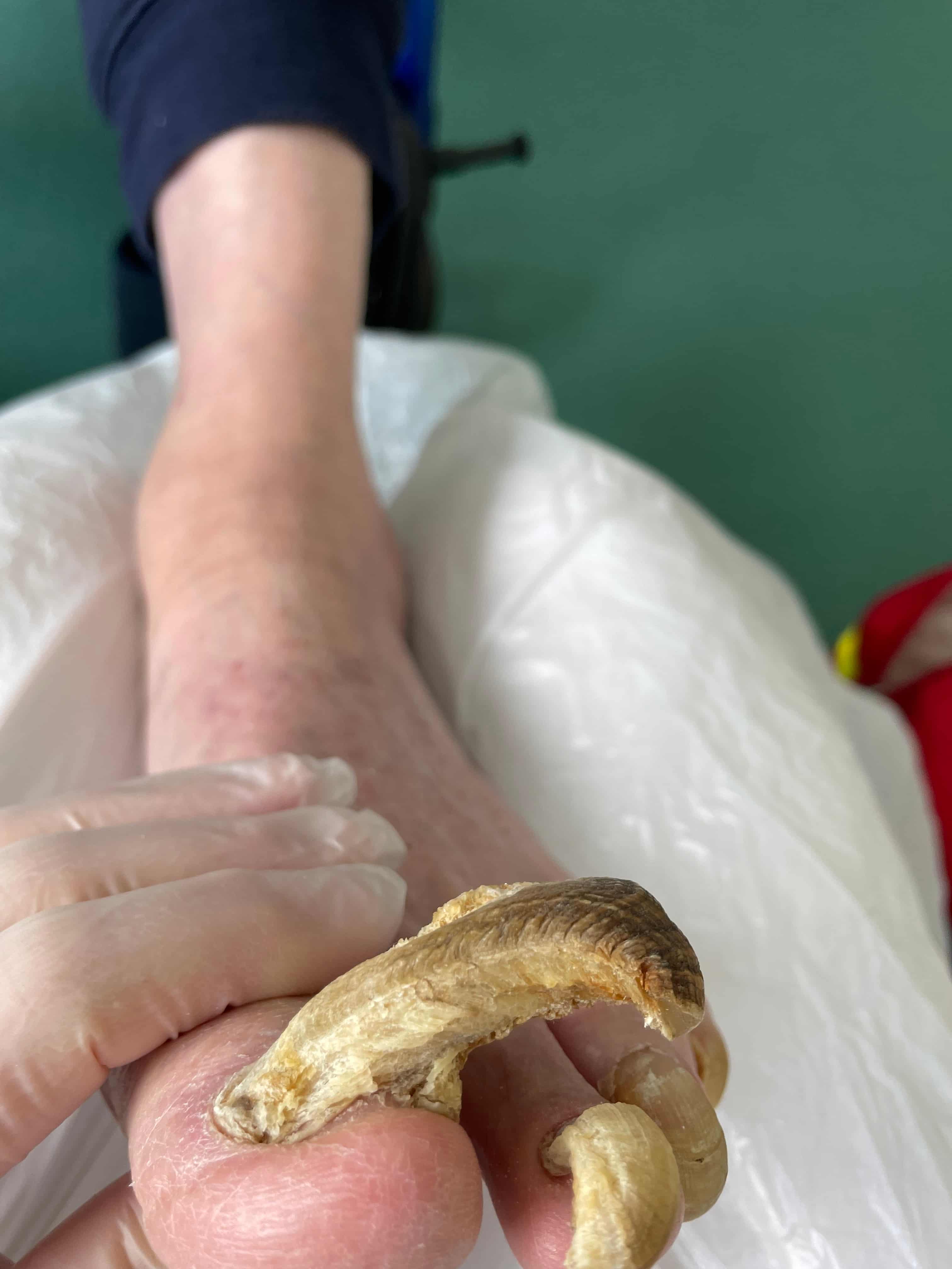soin pedicure avant